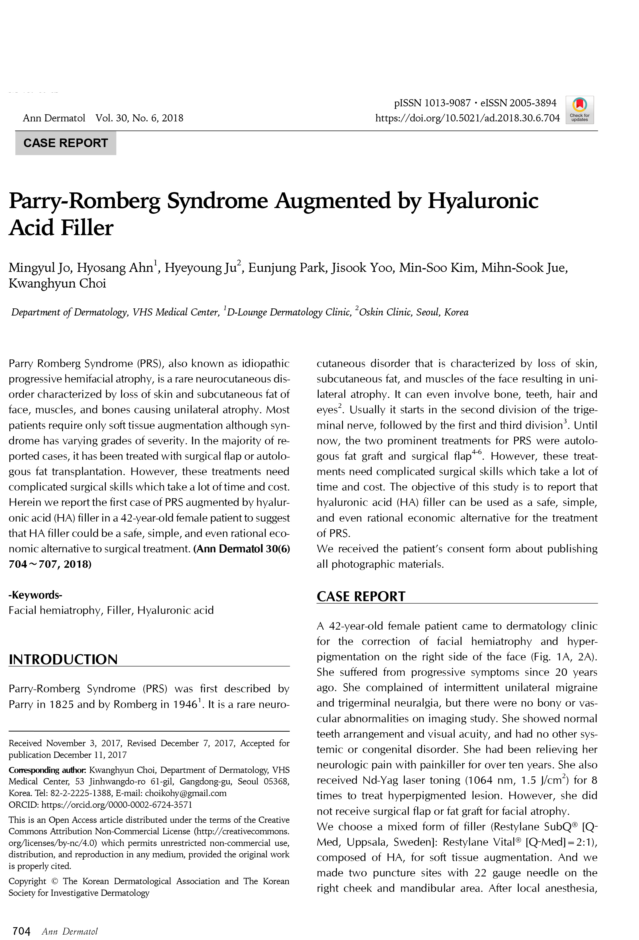 Parry-Romberg_Syndrome_Augmented_by_Hyaluronic_Aci-1.jpg